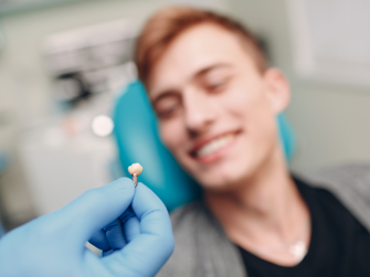 dental-bonding-treatment