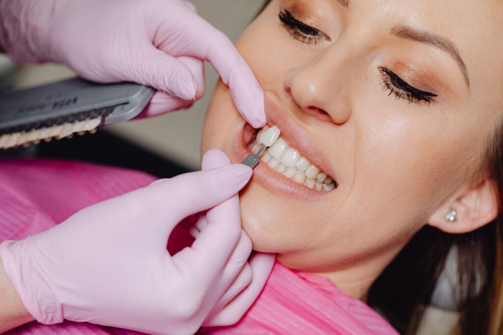 Dentist applying a porcelain veneer during a Hollywood smile Turkey procedure