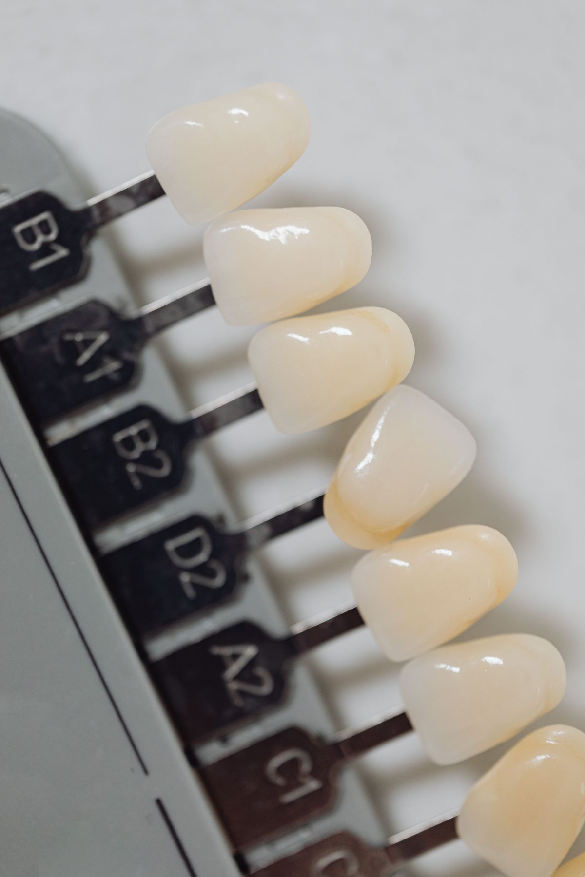 Close-up of finished porcelain veneers giving a Hollywood smile Turkey result